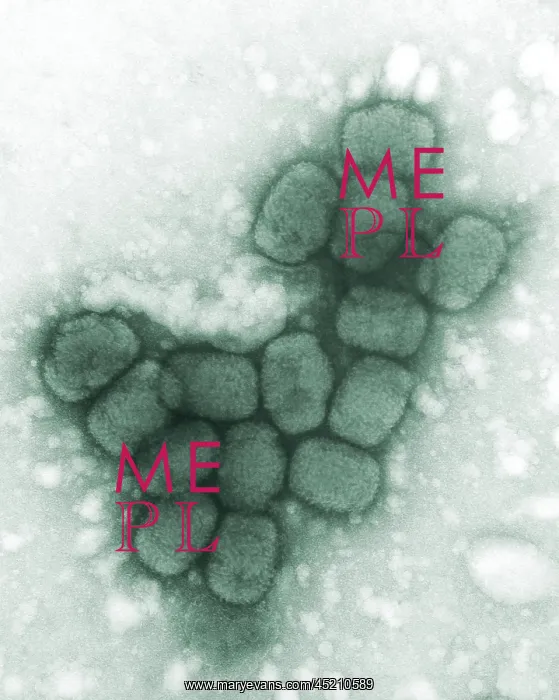 : Smallpox viruses. A colorized transmission ? : Smallpox viruses. A colorized transmission ?