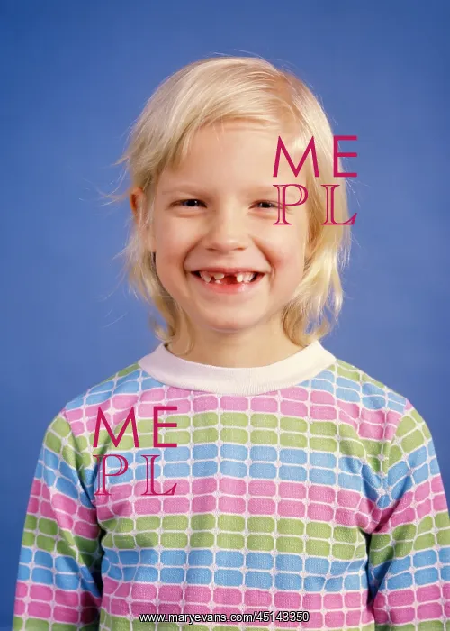: Smiling Blond Girl Missing her Front Teeth Looking : Smiling Blond Girl Missing her Front Teeth Looking