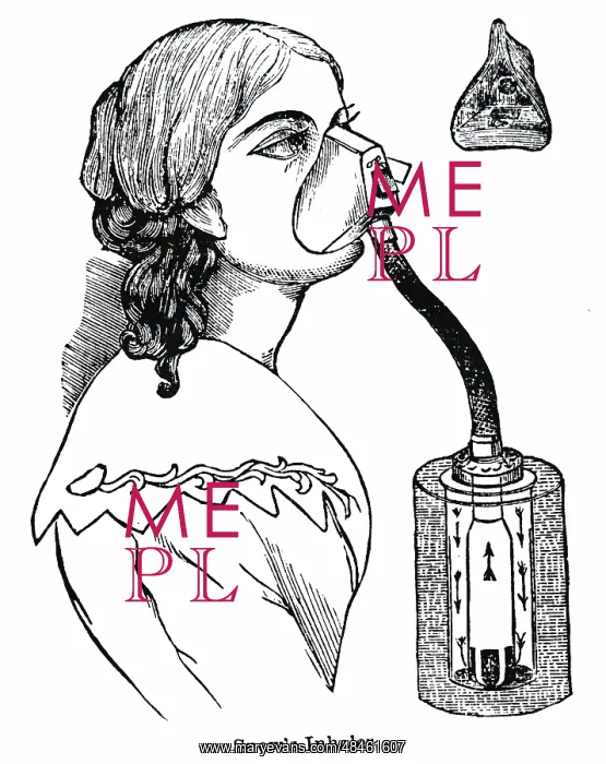 : Snow's inhaler which was used for both chloroform and ether : Snow's inhaler which was used for both chloroform and ether