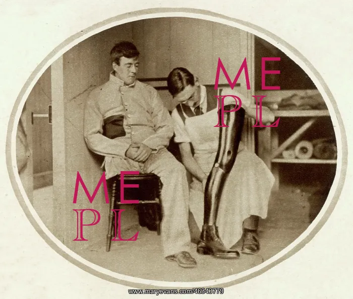 : Soldier receiving an artificial leg 1915 : Soldier receiving an artificial leg 1915