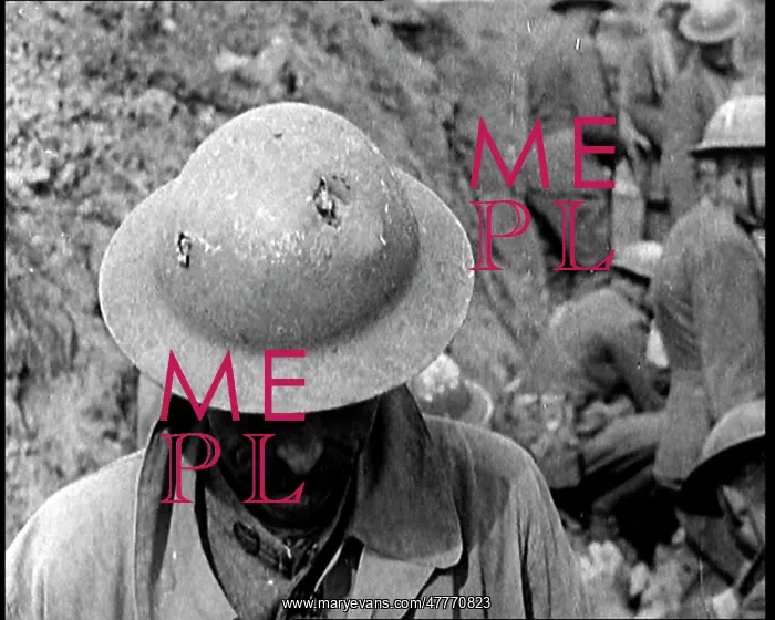 : Soldier Showing the Dents In His Helmet : Soldier Showing the Dents In His Helmet