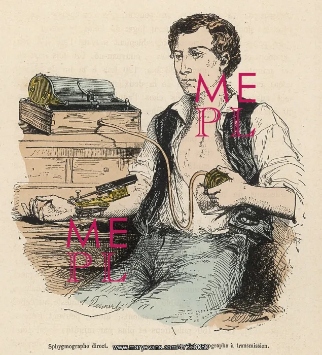 : SPHYGMOGRAPH / 1881 : SPHYGMOGRAPH / 1881