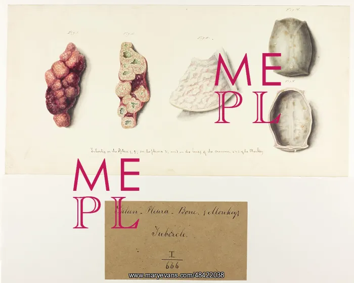 : Spleen. Pleura. Bone. Tubercle. Monkey : Spleen. Pleura. Bone. Tubercle. Monkey