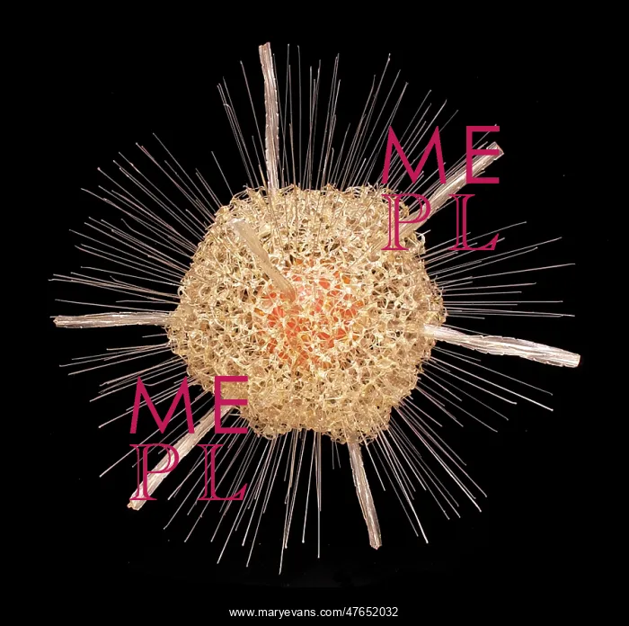 : Spongosphaera streptacantha, radiolarian : Spongosphaera streptacantha, radiolarian