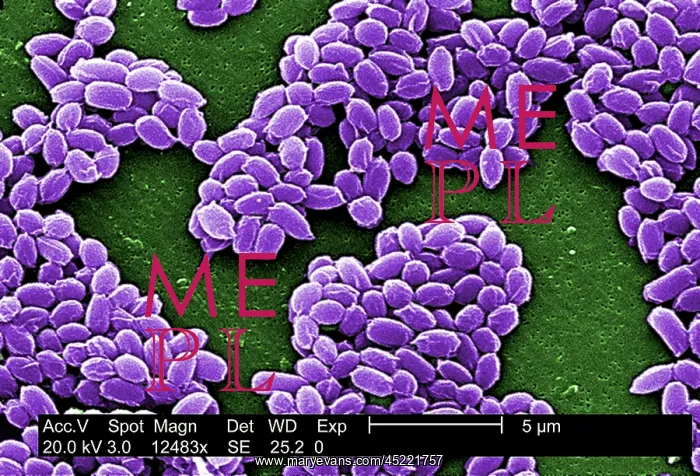 : Spores from an anthrax bacteria. These spores ? : Spores from an anthrax bacteria. These spores ?