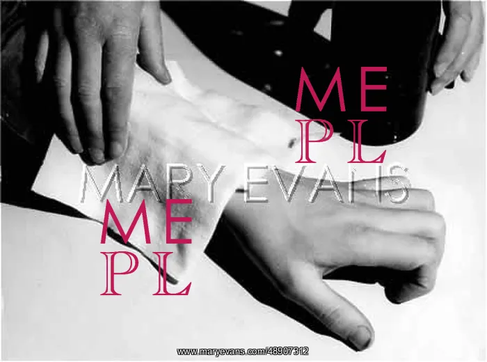  : SPRAINED WRIST / VINEGAR