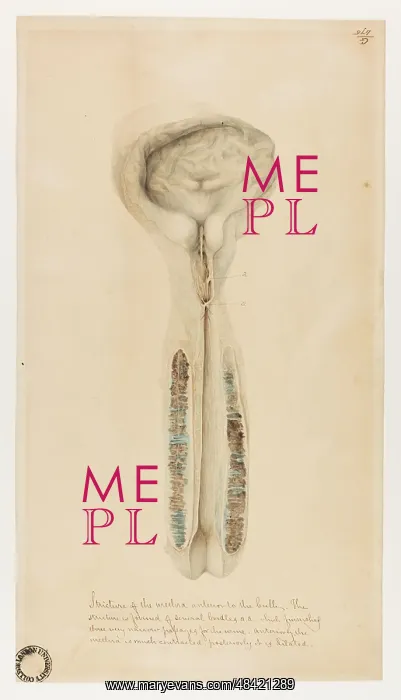 : Stricture of the Urethra Anterior to the Bulb : Stricture of the Urethra Anterior to the Bulb