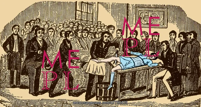  : Surgery Without Anesthesia, pre-1840's