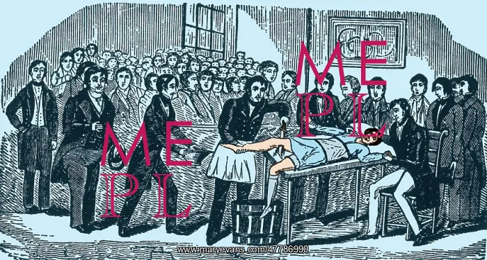 : Surgery Without Anesthesia, pre-1840's : Surgery Without Anesthesia, pre-1840's