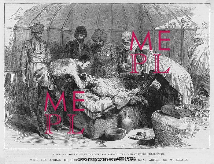 : SURGERY / CHLOROFORM / 1885 : SURGERY / CHLOROFORM / 1885
