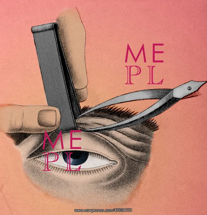 : Surgery to Correct Lazy Eyelid, 1830 : Surgery to Correct Lazy Eyelid, 1830