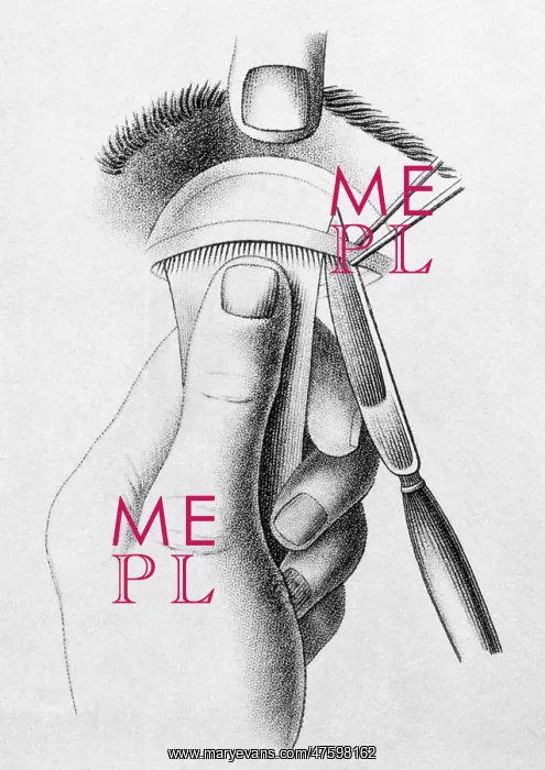 : Surgery to Correct Lazy Upper Eyelid, c, 1830 : Surgery to Correct Lazy Upper Eyelid, c, 1830