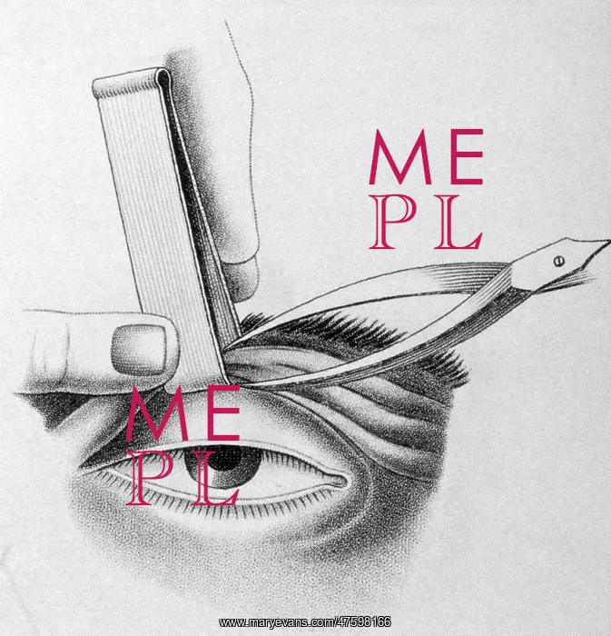 : Surgery to Correct Lazy Upper Eyelid, c, 1830 : Surgery to Correct Lazy Upper Eyelid, c, 1830