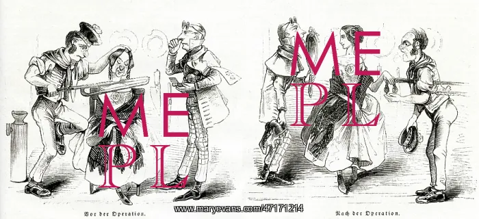 : Surgery cures ugliness 1847 : Surgery cures ugliness 1847