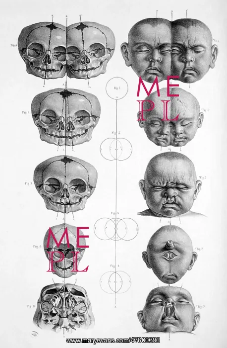 : Surgical Anatomy, 1856 : Surgical Anatomy, 1856