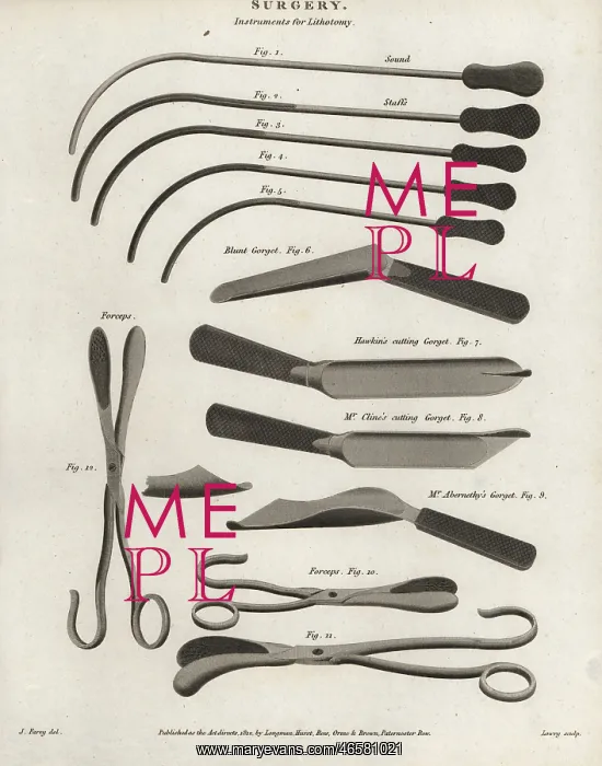 : Surgical equipment for a lithotomy from the 19th century : Surgical equipment for a lithotomy from the 19th century