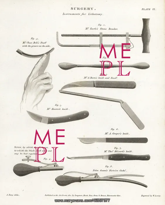 : Surgical equipment for a lithotomy : Surgical equipment for a lithotomy