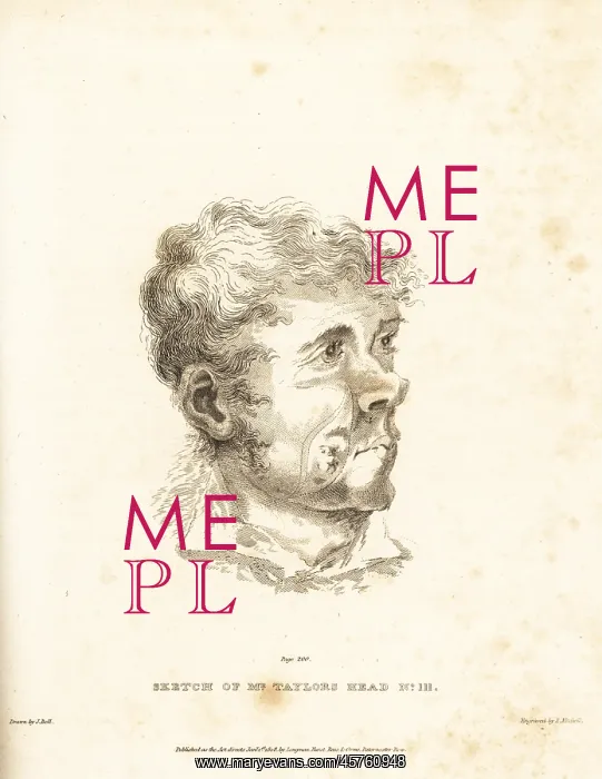 : Surgical operation on the tumor in the cheek of Mr Taylor : Surgical operation on the tumor in the cheek of Mr Taylor