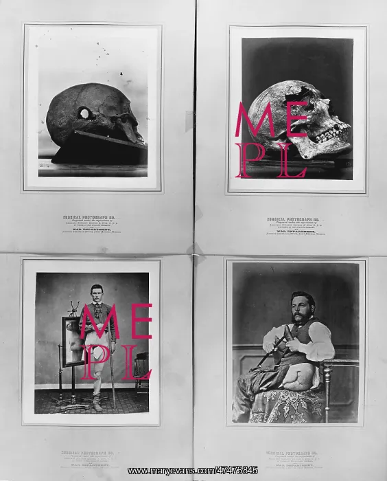 : Surgical photograph... prepared under the supervision of : Surgical photograph... prepared under the supervision of