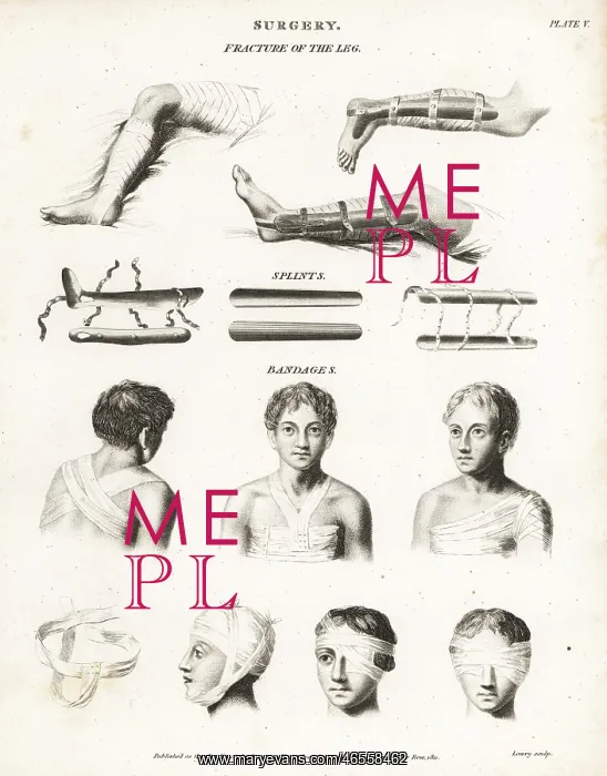 : Surgical procedures from the 19th century : Surgical procedures from the 19th century
