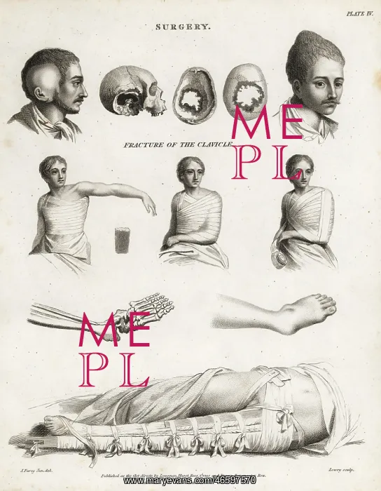 : Surgical procedures from the 19th century : Surgical procedures from the 19th century