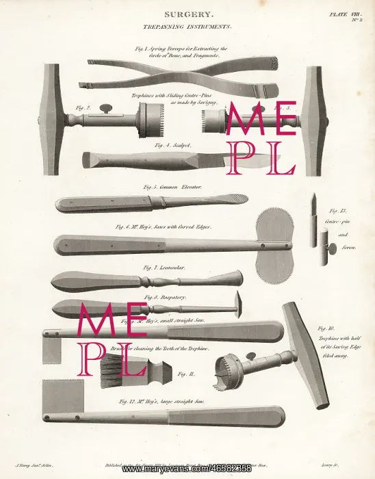 : Surgical trepanning equipment from the 19thC : Surgical trepanning equipment from the 19thC