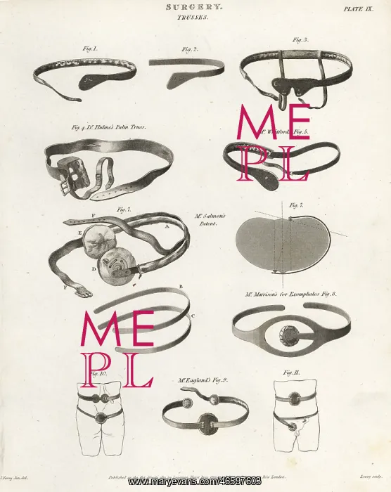 : Surgical trusses from the 19th century : Surgical trusses from the 19th century