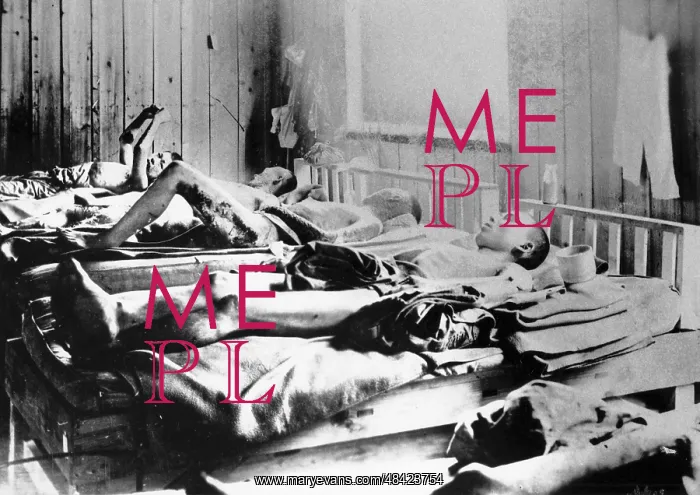 : Survivors of the explosion of the Atom bomb at : Survivors of the explosion of the Atom bomb at