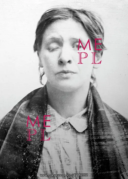 : Symptom of Syphilis, 1920s projection slide : Symptom of Syphilis, 1920s projection slide