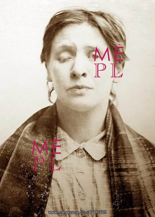 : Symptom of Syphilis, 1920s projection slide : Symptom of Syphilis, 1920s projection slide