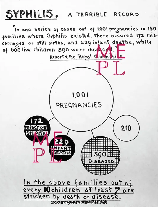 : Syphilis and pregnancy, 1920s projection slide : Syphilis and pregnancy, 1920s projection slide