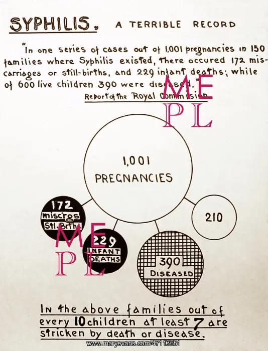 : Syphilis and pregnancy, 1920s projection slide : Syphilis and pregnancy, 1920s projection slide