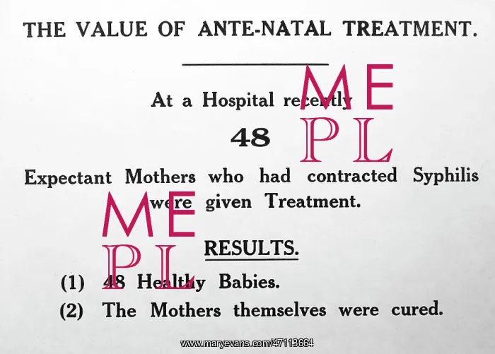 : Syphilis and pregnancy, 1920s projection slide : Syphilis and pregnancy, 1920s projection slide