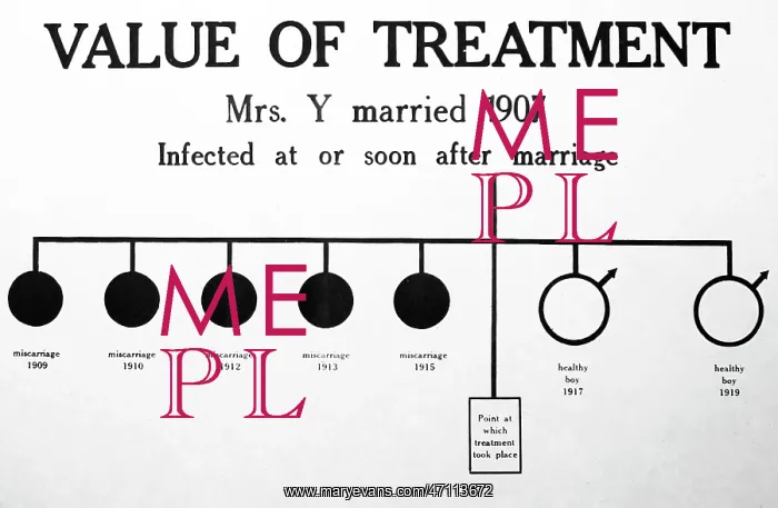 : Syphilis treatment, 1920s projection slide : Syphilis treatment, 1920s projection slide