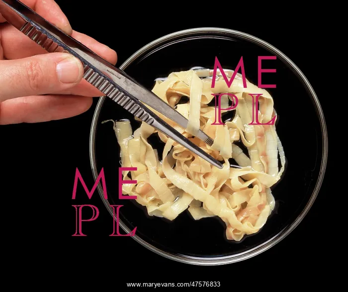 : Taenia saginata, beef tapeworm : Taenia saginata, beef tapeworm