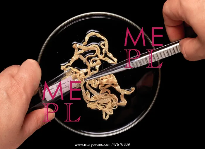 : Taenia solium, pork tapeworm : Taenia solium, pork tapeworm