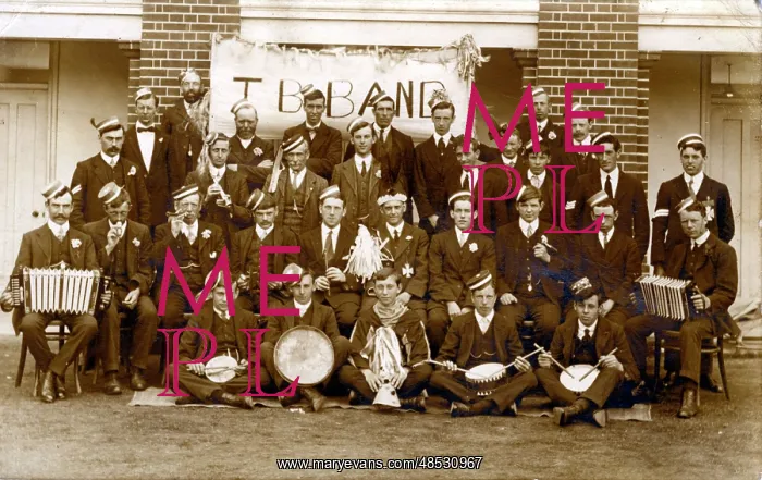 : TB Band, England. Tuberculosis Patients