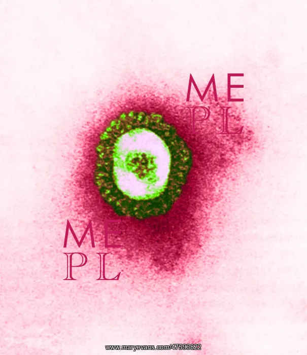 : TEM of Coronavirus : TEM of Coronavirus