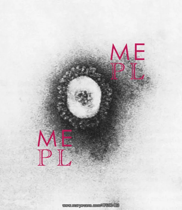 : TEM of Coronavirus : TEM of Coronavirus