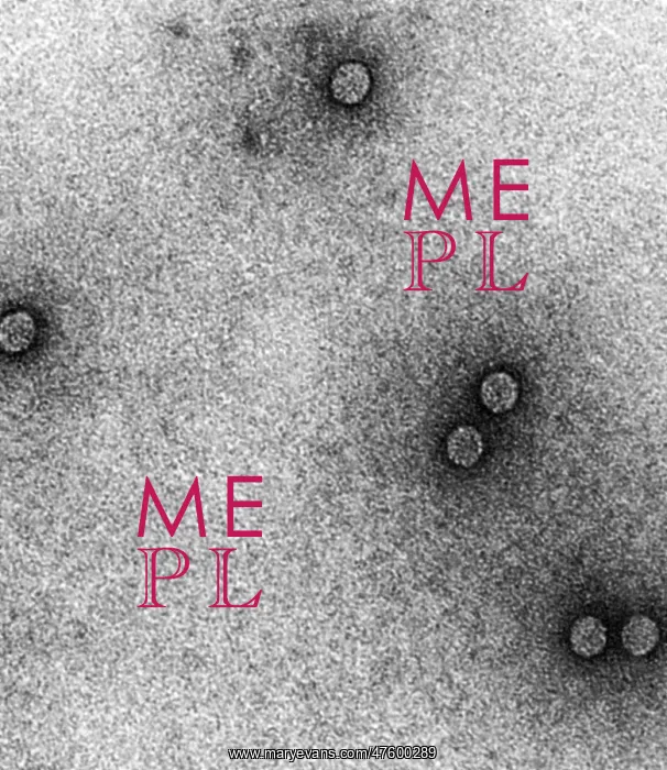 : TEM of Rhinoviruses : TEM of Rhinoviruses