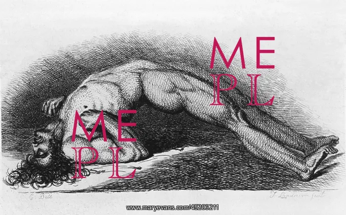 : Tetanus (Lockjaw) victim. The contracted ? : Tetanus (Lockjaw) victim. The contracted ?