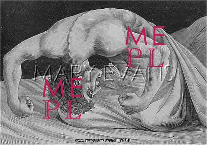 : TETANUS VICTIM - 2 : TETANUS VICTIM - 2