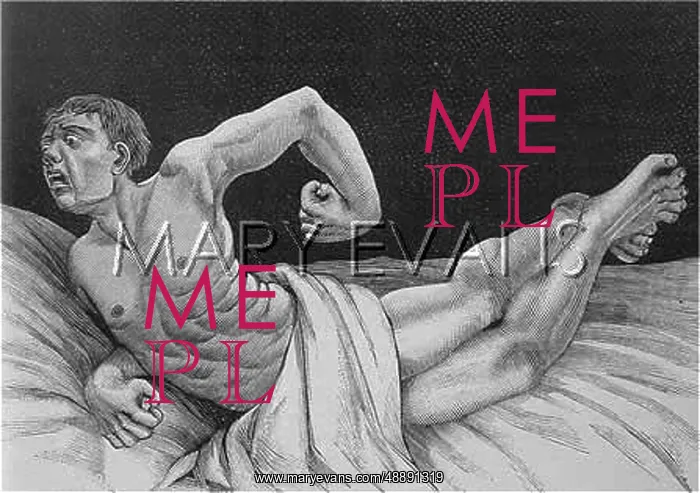 : TETANUS VICTIM - 3 : TETANUS VICTIM - 3