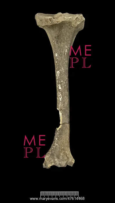 : Tibia of Achondroplastic Dwarf : Tibia of Achondroplastic Dwarf