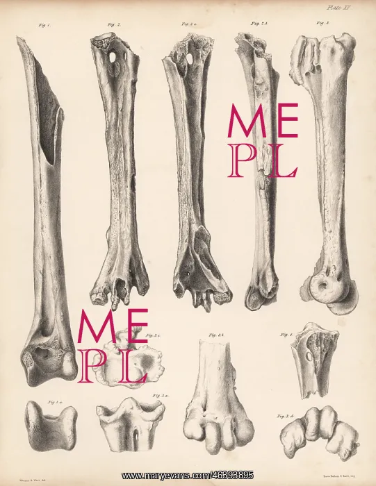 : Tibia and metatarsus of the extinct Rodrigues : Tibia and metatarsus of the extinct Rodrigues