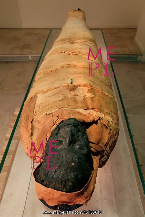 : Tissue sampling operation of an Egyptian mummy : Tissue sampling operation of an Egyptian mummy