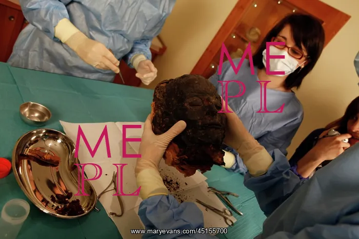 : Tissue sampling operation of an Egyptian mummy : Tissue sampling operation of an Egyptian mummy