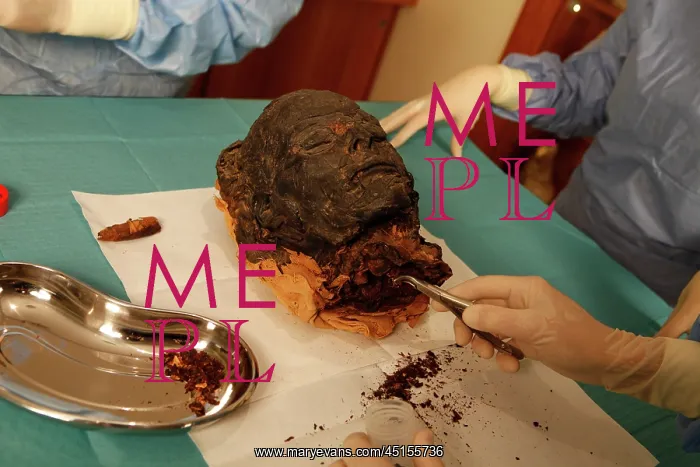 : Tissue sampling operation of an Egyptian mummy : Tissue sampling operation of an Egyptian mummy