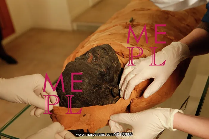 : Tissue sampling operation of an Egyptian mummy : Tissue sampling operation of an Egyptian mummy