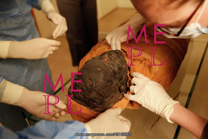 : Tissue sampling operation of an Egyptian mummy : Tissue sampling operation of an Egyptian mummy